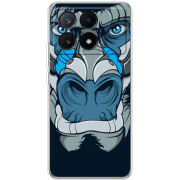 Чехол BoxFace Xiaomi Poco X6 Pro 5G 