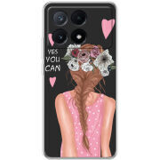 Чехол BoxFace Xiaomi Poco X6 Pro 5G You Can