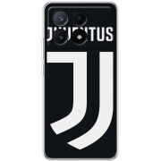 Чехол BoxFace Xiaomi Poco X6 Pro 5G FC J