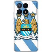 Чехол BoxFace Xiaomi Poco X6 Pro 5G 