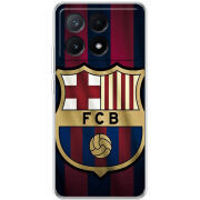 Чехол BoxFace Xiaomi Poco X6 Pro 5G 