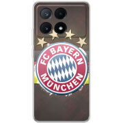 Чехол BoxFace Xiaomi Poco X6 Pro 5G 