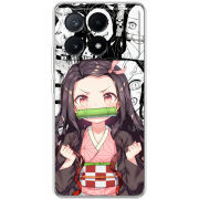 Чехол BoxFace Xiaomi Poco X6 Pro 5G 