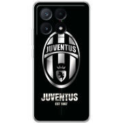 Чехол BoxFace Xiaomi Poco X6 Pro 5G 