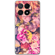 Чехол BoxFace Xiaomi Poco X6 Pro 5G 