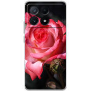 Чехол BoxFace Xiaomi Poco X6 Pro 5G 