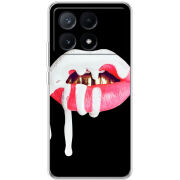 Чехол BoxFace Xiaomi Poco X6 Pro 5G 