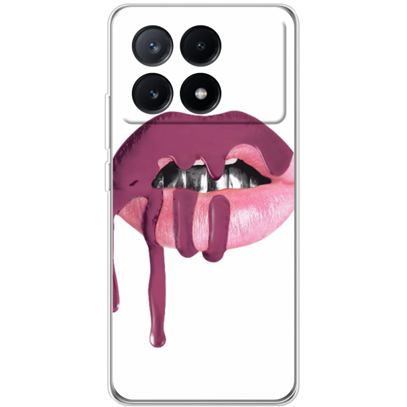 Чехол BoxFace Xiaomi Poco X6 Pro 5G 