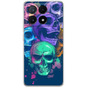 Чехол BoxFace Xiaomi Poco X6 Pro 5G 