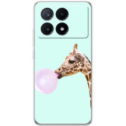 Чехол BoxFace Xiaomi Poco X6 Pro 5G 