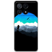 Чехол BoxFace Xiaomi Poco X6 Pro 5G 