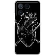 Чехол BoxFace Xiaomi Poco X6 Pro 5G 