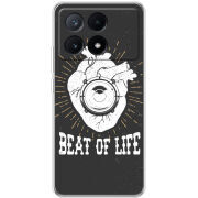 Чехол BoxFace Xiaomi Poco X6 Pro 5G 