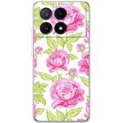 Чехол BoxFace Xiaomi Poco X6 Pro 5G 