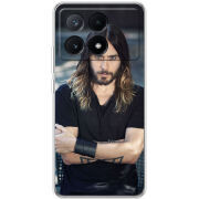 Чехол BoxFace Xiaomi Poco X6 Pro 5G 