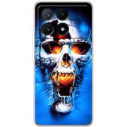 Чехол BoxFace Xiaomi Poco X6 Pro 5G 