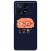 Чехол BoxFace Xiaomi Poco X6 Pro 5G 