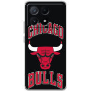 Чехол BoxFace Xiaomi Poco X6 Pro 5G 