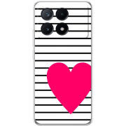 Чехол BoxFace Xiaomi Poco X6 Pro 5G 