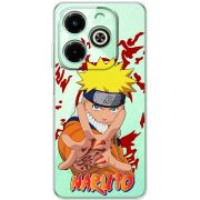 Прозрачный чехол BoxFace Infinix Hot 40i Naruto