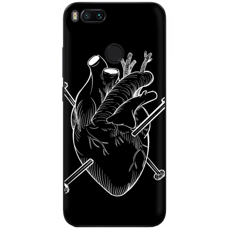 Чехол Uprint Xiaomi Mi5X / Mi A1 