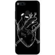 Чехол Uprint Xiaomi Mi5X / Mi A1 