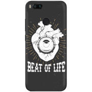 Чехол Uprint Xiaomi Mi5X / Mi A1 