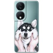 Прозрачный чехол BoxFace Honor X7b Husky