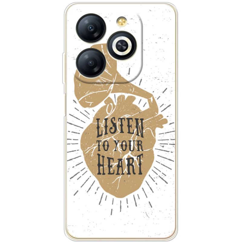 Чехол BoxFace Infinix Smart 8 