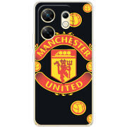 Чехол BoxFace Infinix Zero 30 4G FC Manchester-U