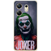 Чехол BoxFace Infinix Zero 30 4G Joker