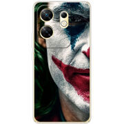 Чехол BoxFace Infinix Zero 30 4G Joker Background