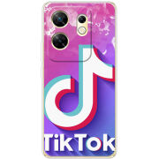 Чехол BoxFace Infinix Zero 30 4G TikTok