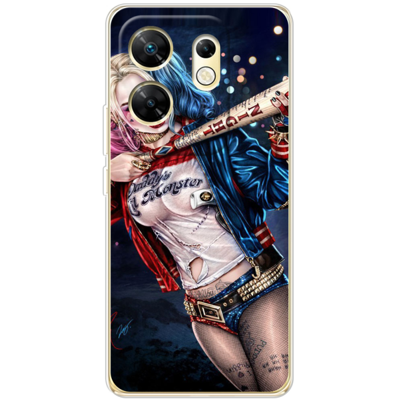 Чехол BoxFace Infinix Zero 30 4G Harley Quinn