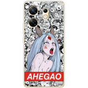 Чехол BoxFace Infinix Zero 30 4G Ahegao