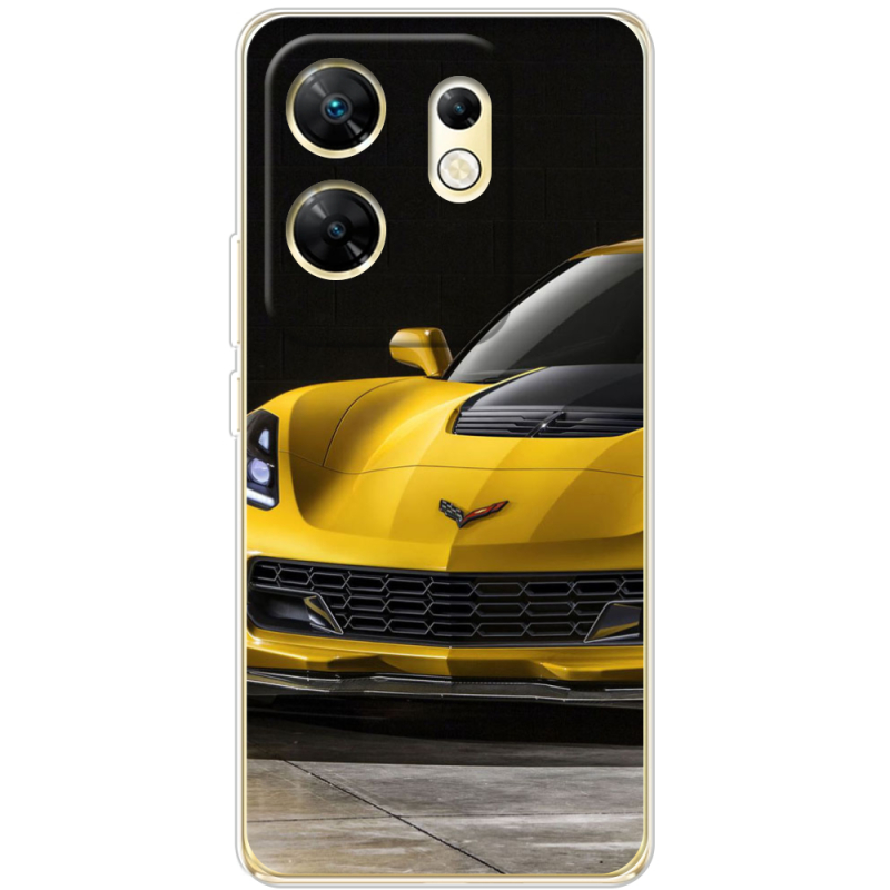 Чехол BoxFace Infinix Zero 30 4G Corvette Z06