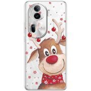 Прозрачный чехол BoxFace OPPO Reno 11 Pro 5G Winter Deer