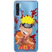 Прозрачный чехол BoxFace TCL 20L Plus Naruto