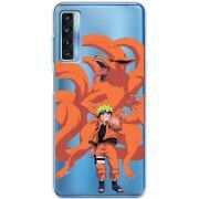 Прозрачный чехол BoxFace TCL 20L Plus Naruto and Kurama