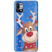 Прозрачный чехол BoxFace Umidigi Power 5 Winter Deer