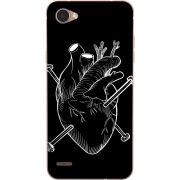 Чехол Uprint LG Q6 A / Plus LGM700 