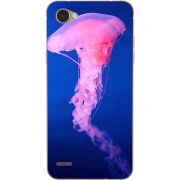 Чехол Uprint LG Q6 A / Plus LGM700 