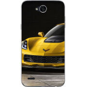 Чехол Uprint LG X Power 2 M320 Corvette Z06