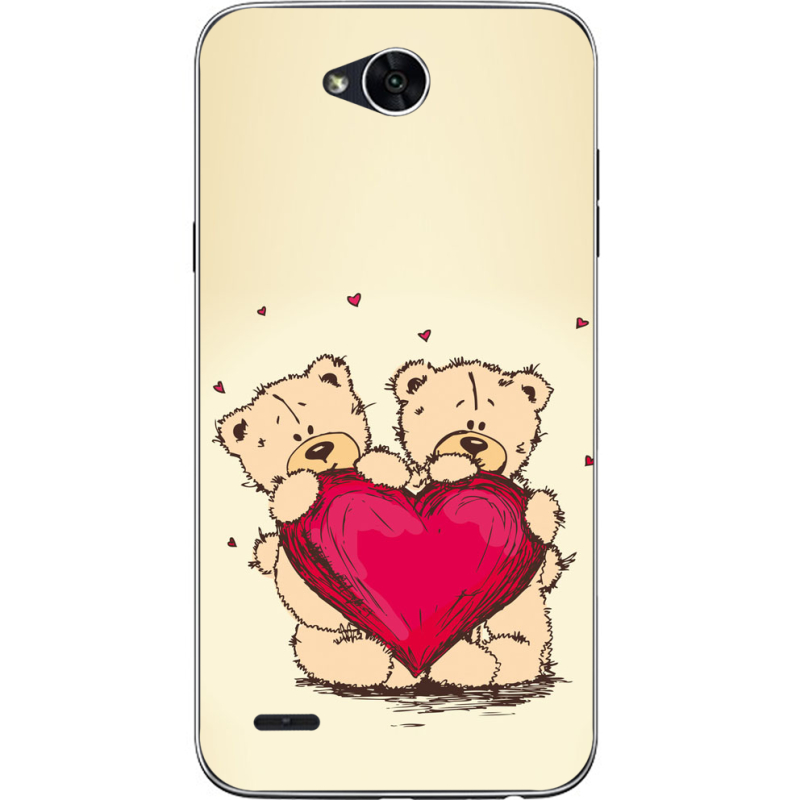 Чехол Uprint LG X Power 2 M320 Teddy Bear Love