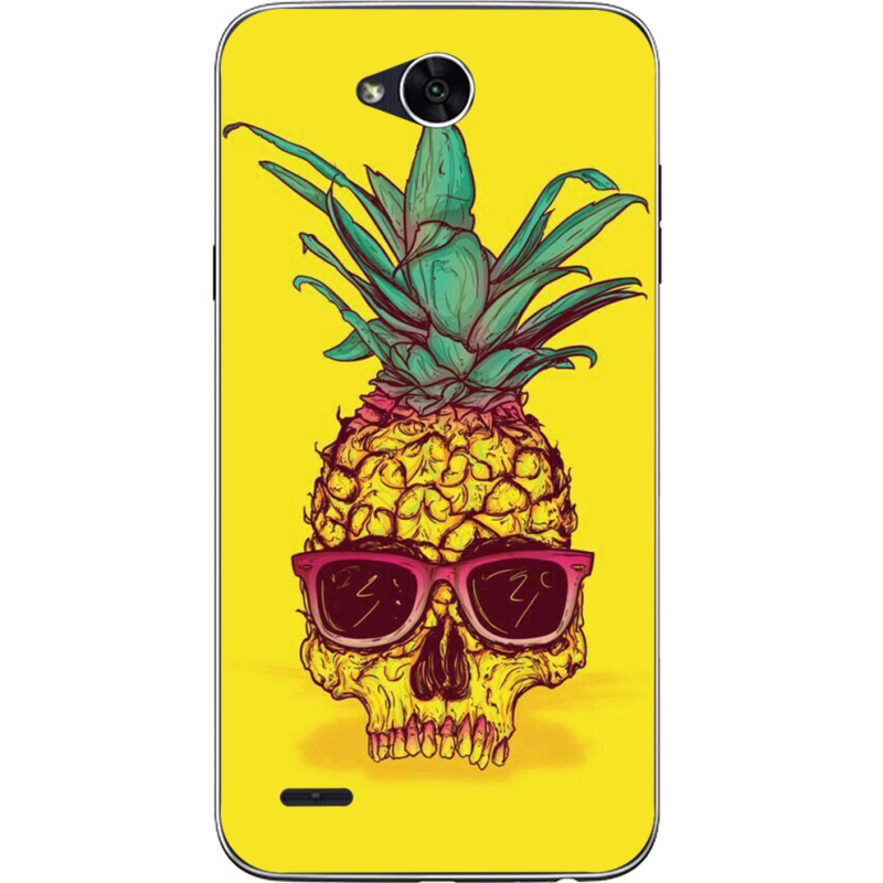 Чехол Uprint LG X Power 2 M320 Pineapple Skull