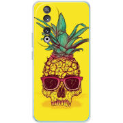 Чехол BoxFace Huawei Honor 90 Pineapple Skull