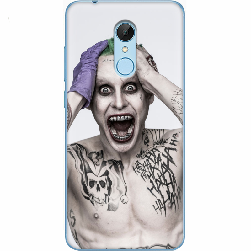 Чехол Uprint Xiaomi Redmi 5 