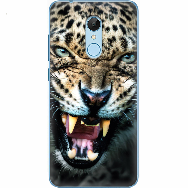 Чехол Uprint Xiaomi Redmi 5 