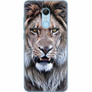 Чехол Uprint Xiaomi Redmi 5 