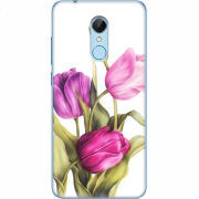 Чехол Uprint Xiaomi Redmi 5 